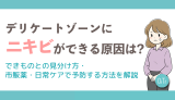 デリケートゾーンにニキビができる原因は？できものとの見分け方・市販薬・日常ケアで予防する方法を解説